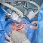 Clear Vision: Prayer for Successful Cataract Surgery Unveiled! 21 Clear Vision: Prayer for Successful Cataract Surgery Unveiled!
